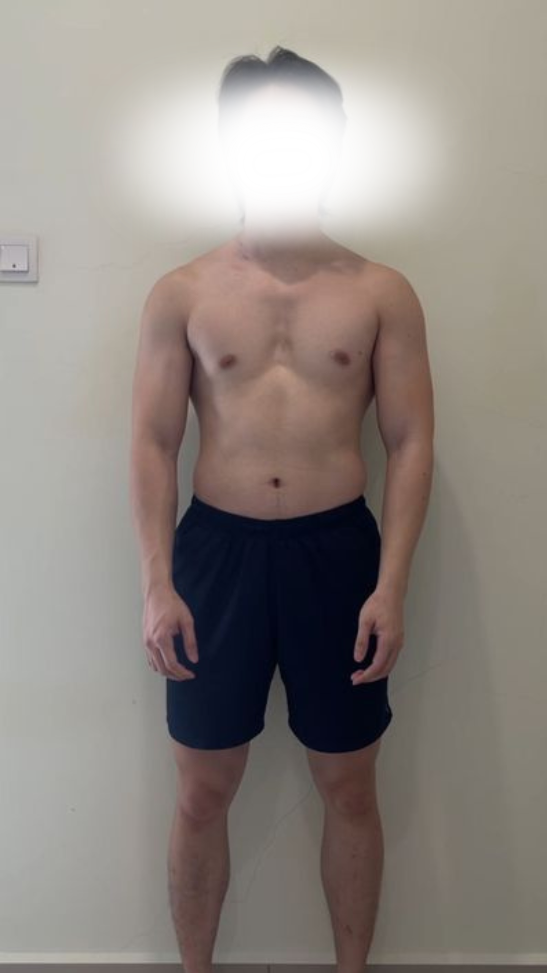 Before transformation
