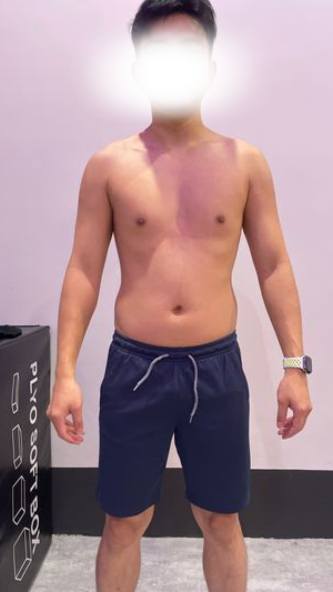 Before transformation