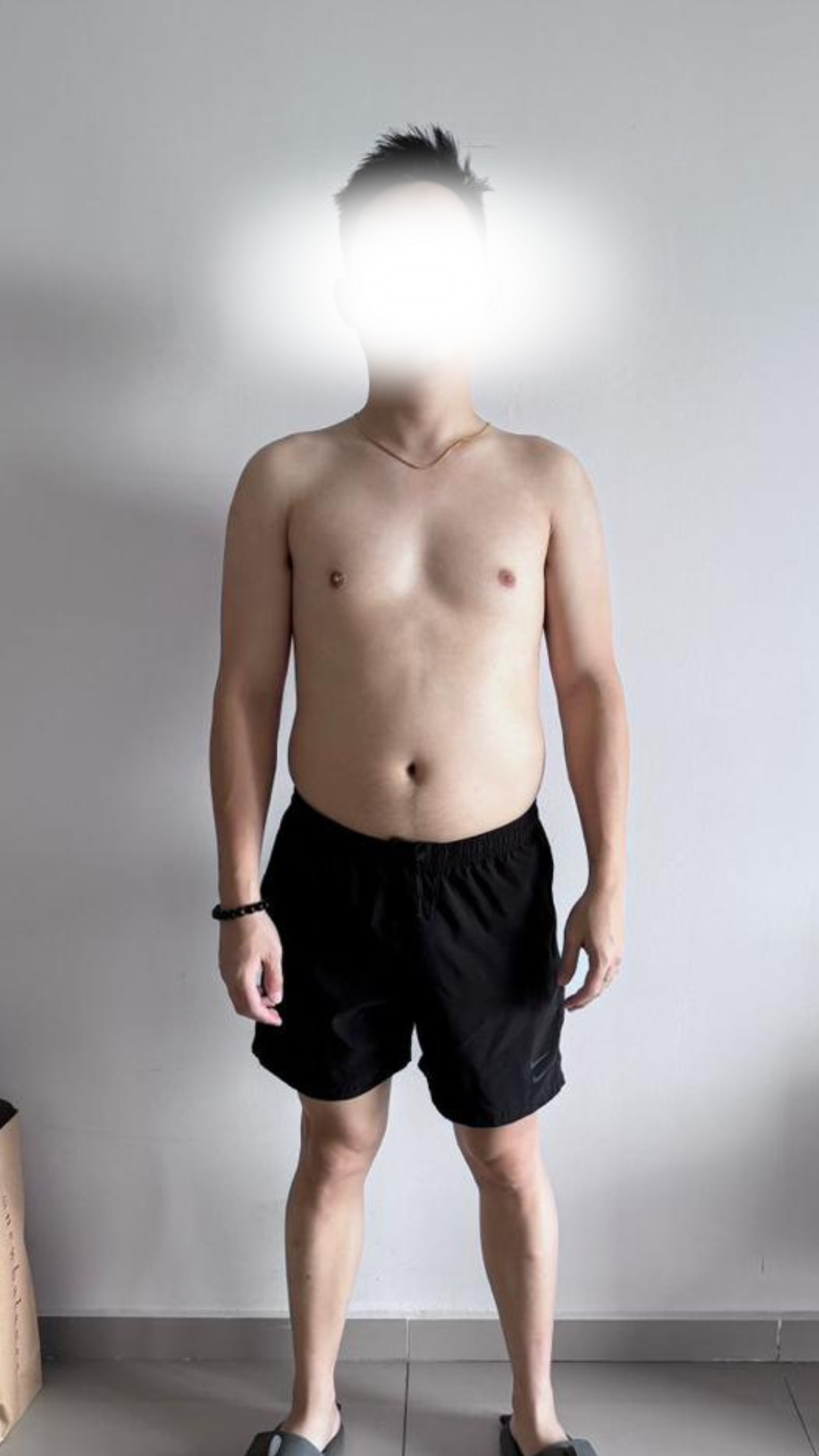 Before transformation