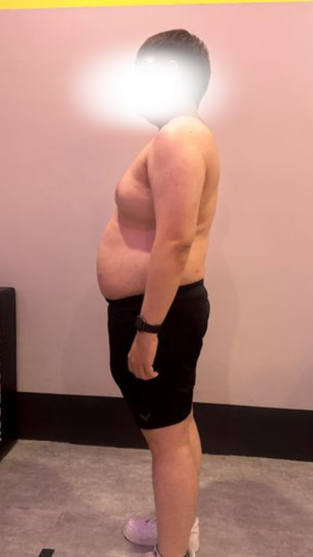 Before transformation