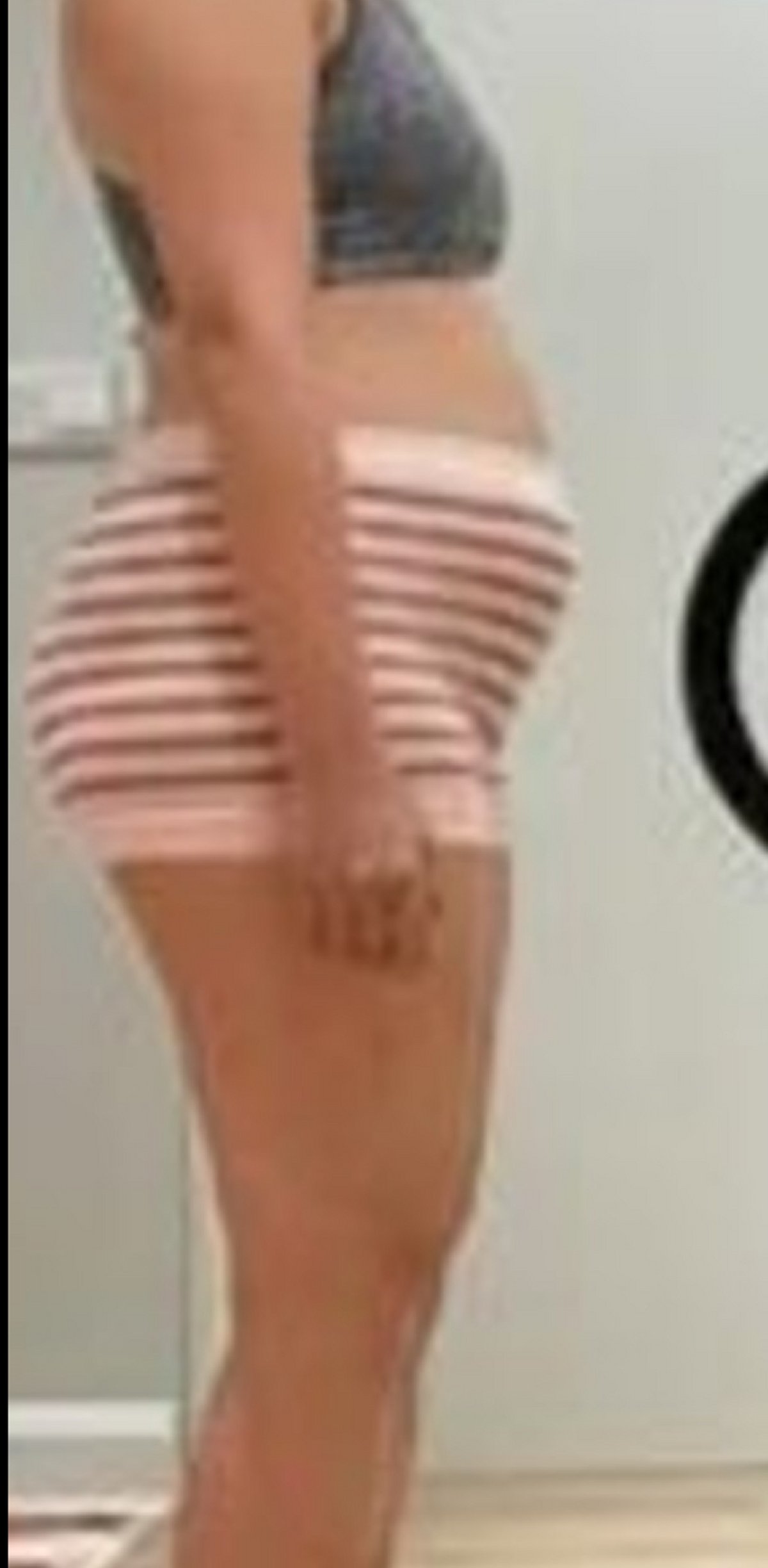 Before transformation