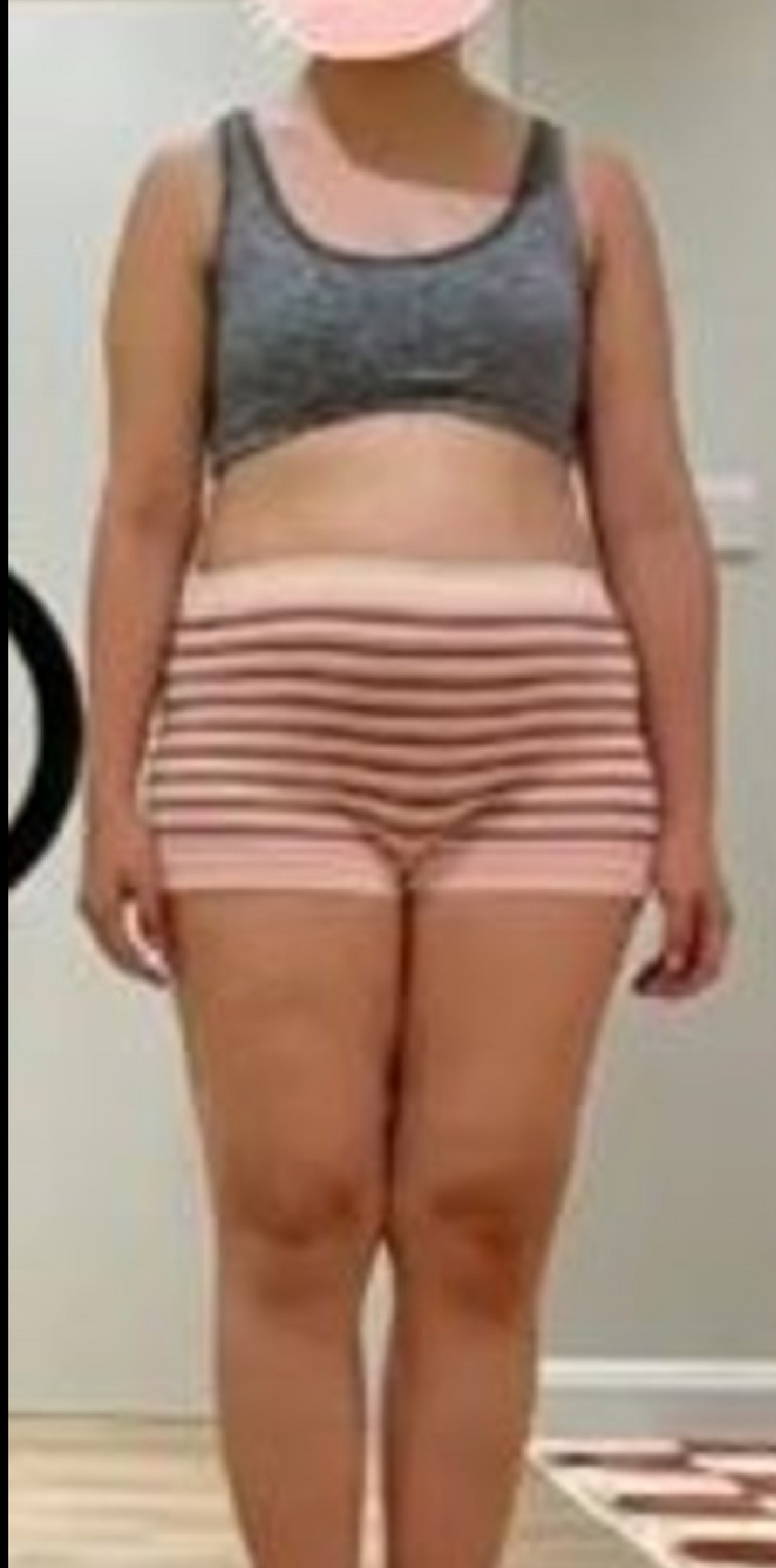 Before transformation