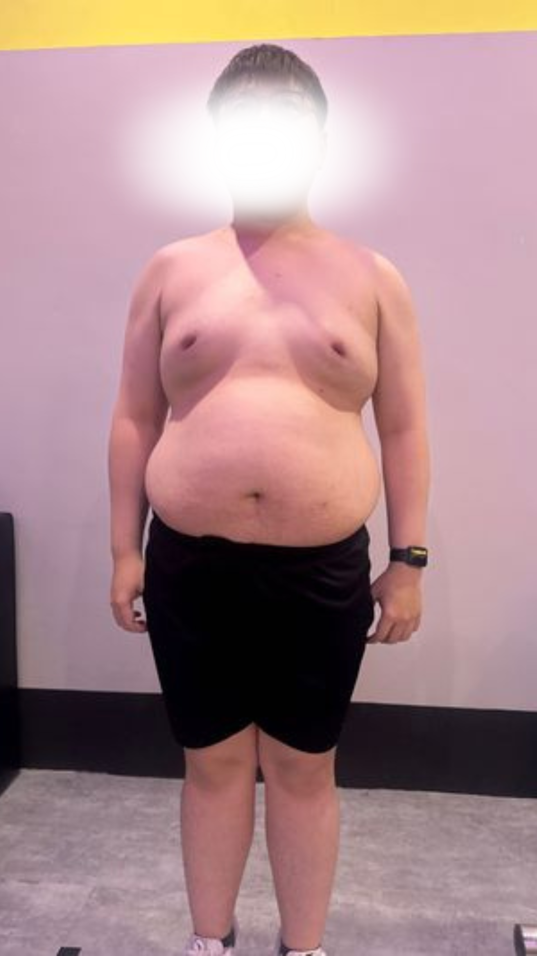 Before transformation