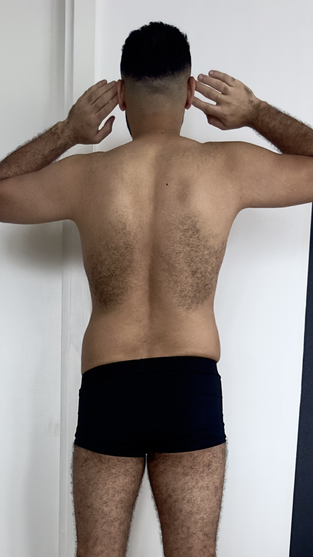 Before transformation