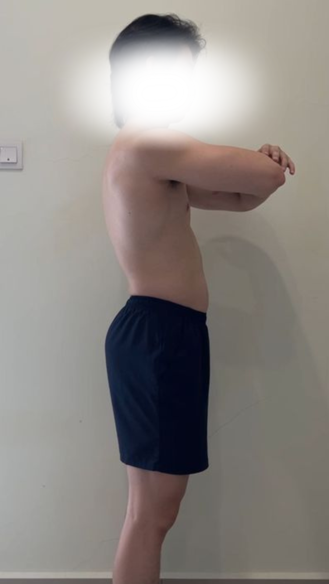 Before transformation