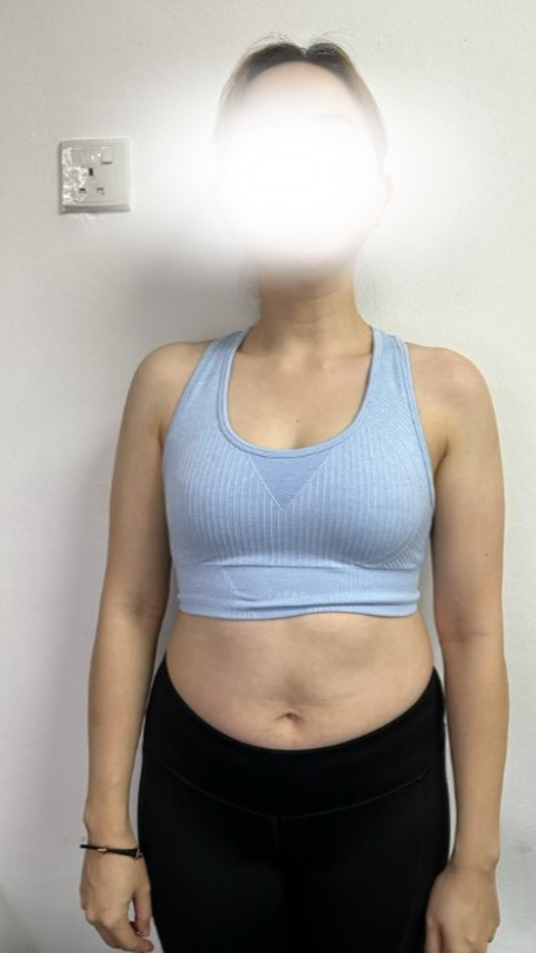 Before transformation