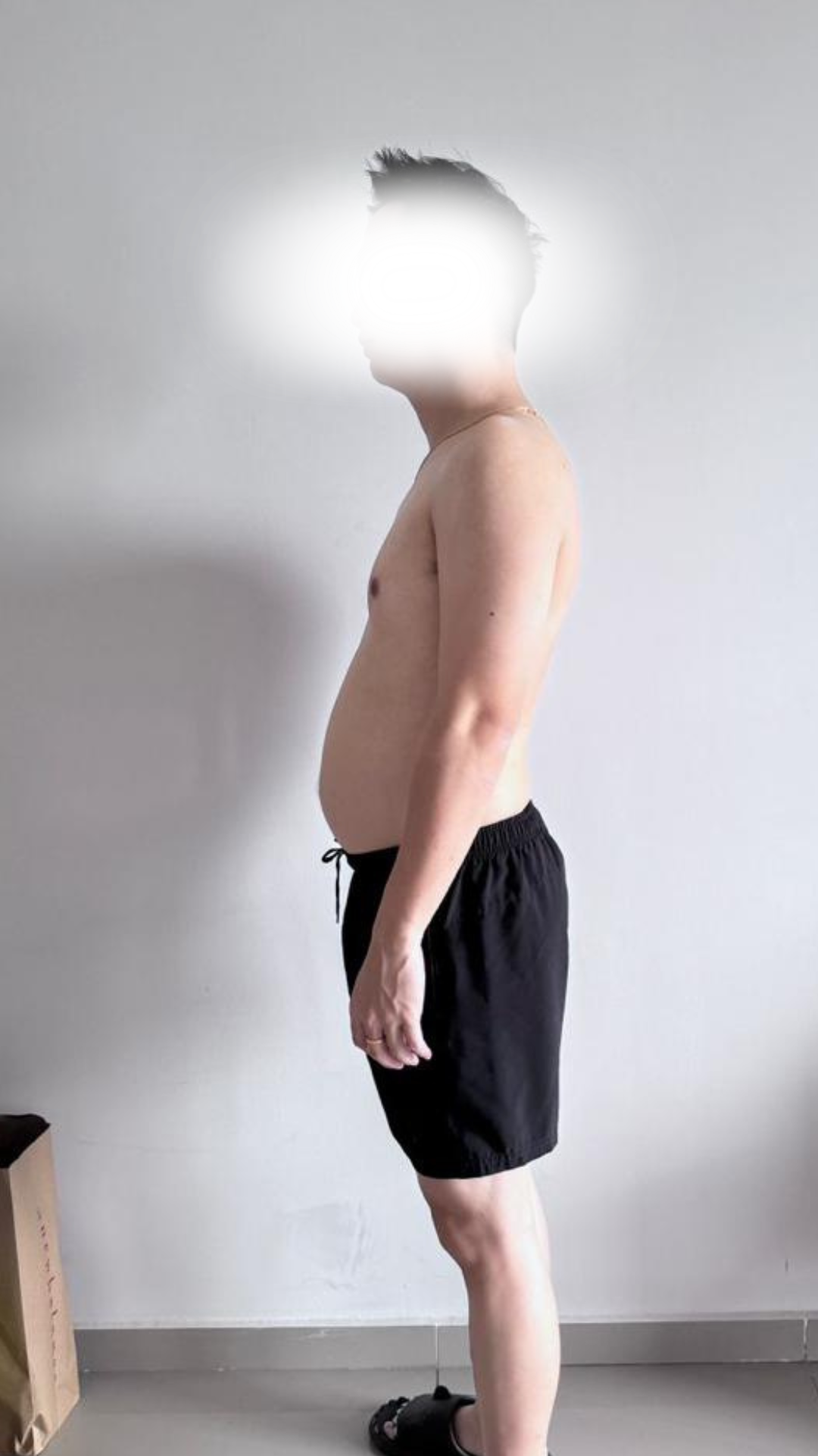 Before transformation