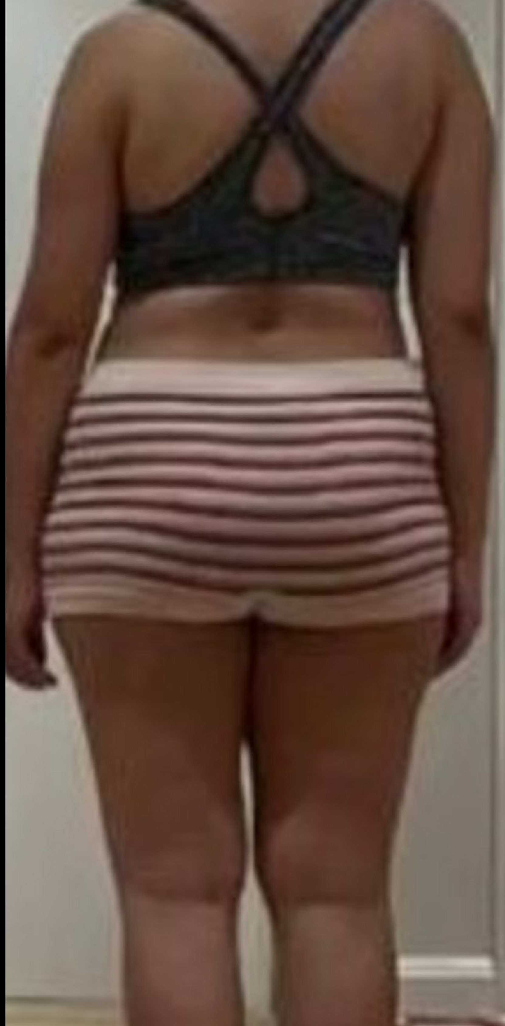 Before transformation